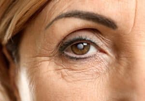 Cataract Surgery in Fredericksburg, VA