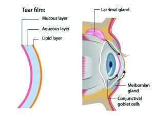 OptiLight dry eye treatment Fredericksburg, Stafford